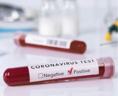 la-sinaia,-rata-de-infectare-cu-coronavirus-a-depasit-din-nou-trei-la-mia-de-locuitori