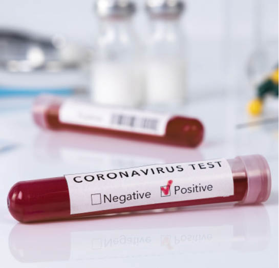 la-sinaia,-rata-de-infectare-cu-coronavirus-a-depasit-din-nou-trei-la-mia-de-locuitori