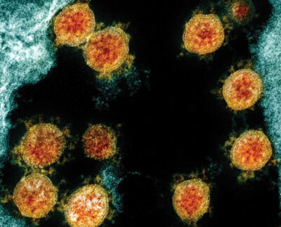 infectia-cu-coronavirus-asigura-imunitate-timp-de-cel-putin-5-luni