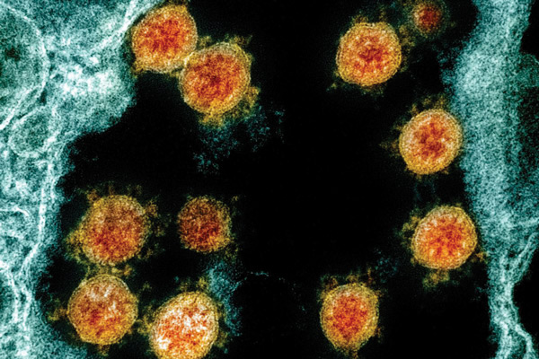 infectia-cu-coronavirus-asigura-imunitate-timp-de-cel-putin-5-luni