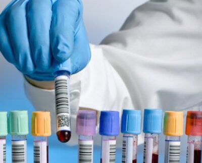 rata-de-infectare-cu-sars-cov-2-la-valea-calugareasca,-la-un-prag-minim