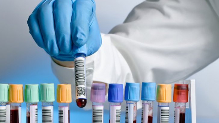 rata-de-infectare-cu-sars-cov-2-la-valea-calugareasca,-la-un-prag-minim